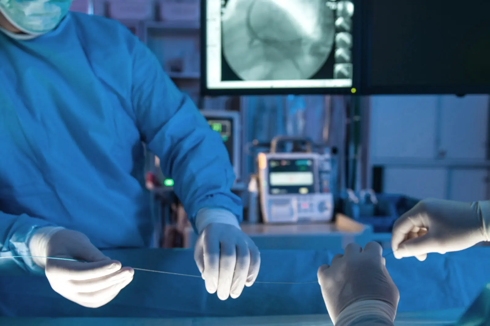 A physician in surgical scrubs advances a guidewire during a catheter-based procedure, with fluoroscopic imaging on the monitor overhead.